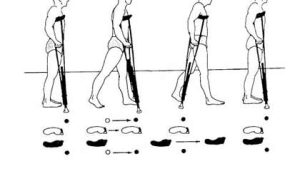 طریقه استفاده از عصا